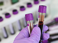 Группа крови покажет личный риск онкологических заболеваний - «Здоровая жизнь»