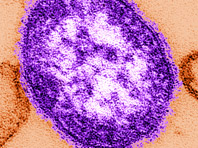 Корь вызывает "иммунную амнезию", предупреждают инфекционисты - «Здоровая жизнь»