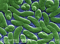 Мировые курорты может захватить бактерия Vibrio vulnificus - «Здоровая жизнь»
