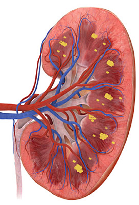 Не смешно до колик - «Здоровая жизнь»