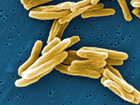 Отечественные химики подошли ближе к избавлению от туберкулеза - «Здоровая жизнь»