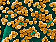 Открытие: аллергия, болезнь кожи и особые бактерии связаны - «Здоровая жизнь»