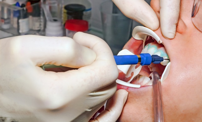 Перекись водорода: мифы и факты к Дню блондинок - «Здоровая жизнь»