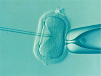 Популярность ЭКО грозит настоящей эпидемией бесплодия - «Здоровая жизнь»