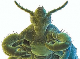 Проверка на вшивость - «Здоровая жизнь»