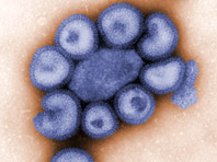 Российские вирусологи поняли, как победить постоянно мутирующий грипп - «Здоровая жизнь»