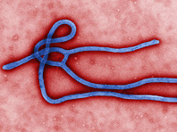 Стартуют испытания новой вакцины против лихорадки Эбола - «Здоровая жизнь»