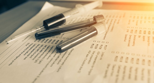 ВИЧ и стоматология: можно ли заразиться? - «Здоровая жизнь»