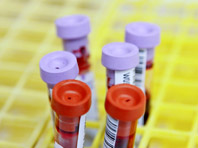 Врачи предлагают по-новому трактовать анализы крови - «Здоровая жизнь»