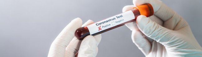 В РФ запущено производство новой тест-системы для диагностики коронавируса - «Инфекционные заболевания»