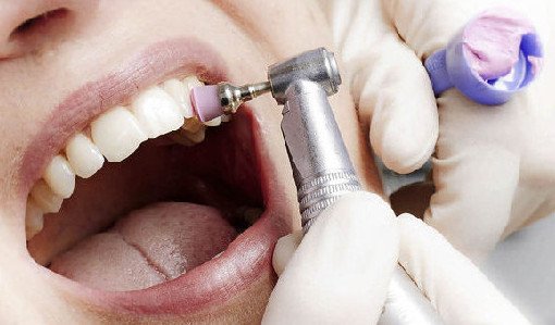 10 важных правил гигиены полости рта - «Стоматология»