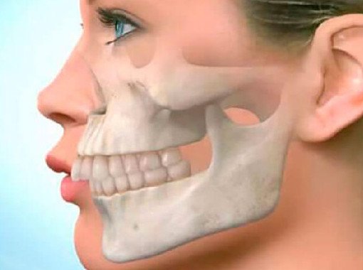 "Птичий профиль" и другие дефекты, которые исправит только стоматолог - «Стоматология»