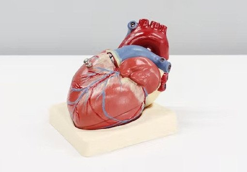 Кардиолог Кузнецов рассказал, что позволяет узнать нетипичный инфаркт - «Новости Медицины»
