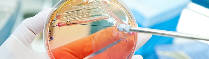 Сохранит ли E. coli свои лидирующие позиции как возбудитель инфекции мочевых путей у детей? - «Кардиология»