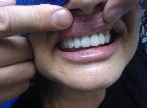 Стоматолог Шаргородский назвал разрушающую зубы частую привычку - «Стоматология»
