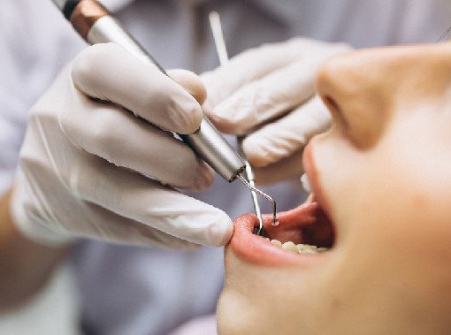 Стоматолог Касем перечислил самые вредные для зубов продукты - «Стоматология»