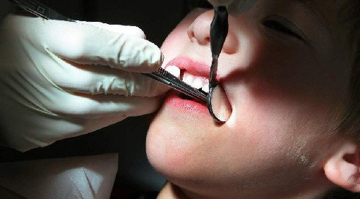 Стоматолог Саад рассказала, что нельзя делать с зубами - «Стоматология»