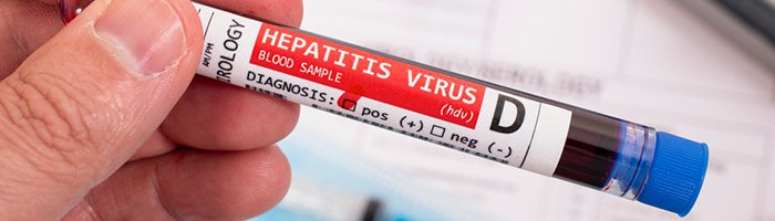 Вирусный гепатит D - «Инфекционные заболевания»