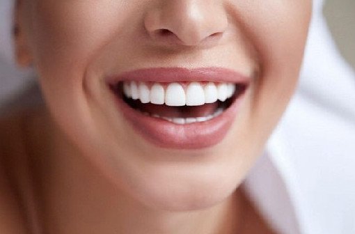 Секреты красивой улыбки: рассказывает эксперт - «Стоматология»