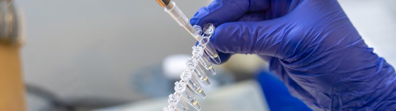 Новый тест для быстрого выявления возбудителей шигиллеза разработан учеными Роспотребнадзора - «Новости Медицины»