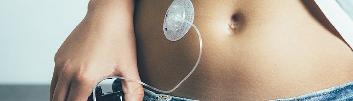 На территории РФ Росздравнадзором зарегистрировано 11 систем непрерывного мониторинга глюкозы - «Кардиология»