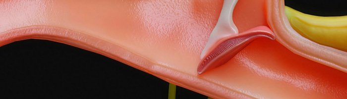 Мирингопластика в раннем посттравматическом периоде - «Аллергология»