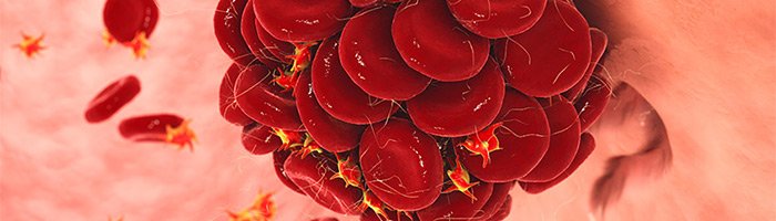 Новый метод выявляет минимальные изменения механизма свертывания крови - «Инфекционные заболевания»