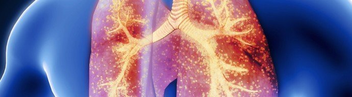 Только 9% взрослых привиты от пневмококка: врачи призывают усилить профилактику пневмонии - «Новости Медицины»