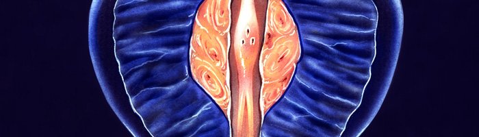 Суперселективная катетеризация простатических артерий при проведении рентгенэндоваскулярного метода лечения доброкачественной гиперплазии предстательной железы: описание клинического случая - «Инфекционные заболевания»