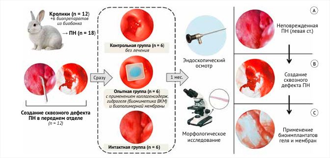 Эффективность комбинированного применения биополимерных материалов для стимулирования регенерации поврежденной слизистой оболочки носа при хирургических вмешательствах - «Инфекционные заболевания»