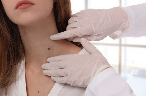 7 сигналов вашей кожи, предупреждающие о серьезных заболеваниях - «Дерматология»